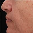pic 2_ age 58 after.jpg