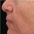 pic 2_age 58 before.jpg