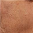 pic 3_age 70_after.jpg