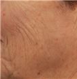 pic 3_age70 before.jpg