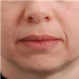 pic 6_age 58 before.jpg