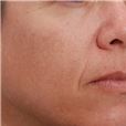 pic 8_age 42 after.jpg