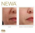 newa before  after_bouche.jpg