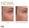 newa before  after_yeux.jpg