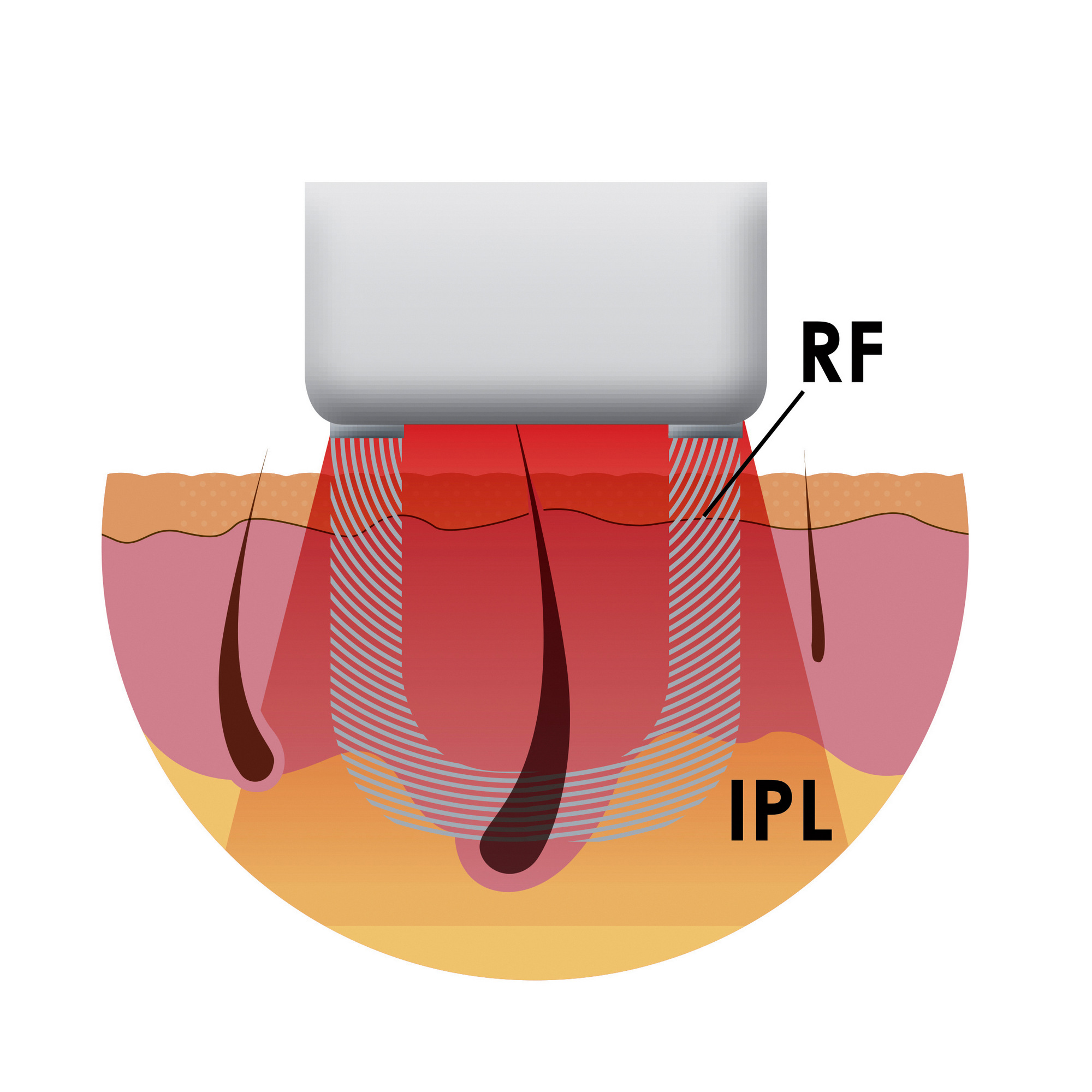 mePro_elosDiagram.jpg