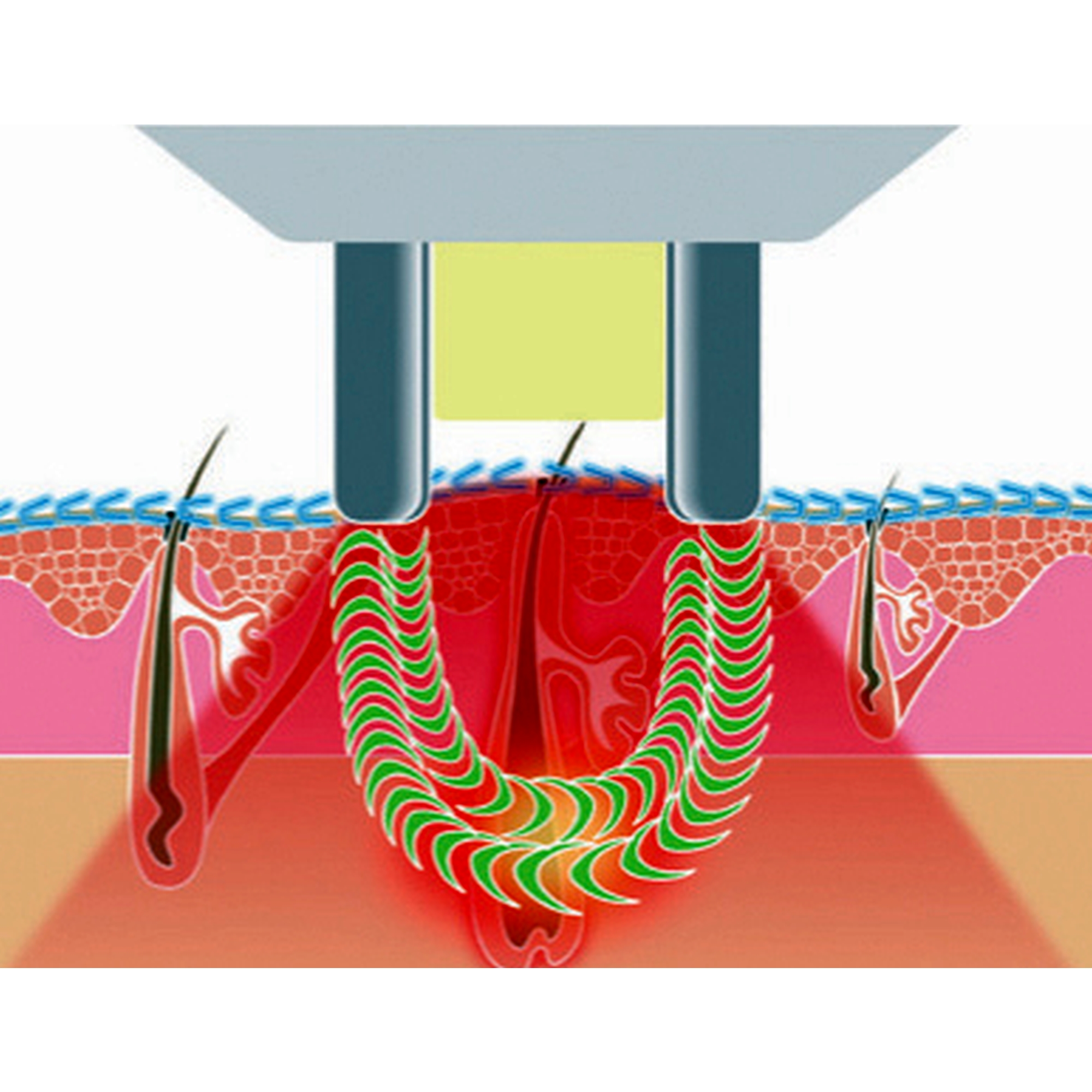 Me Touch _Diagram RF and IPL.jpg