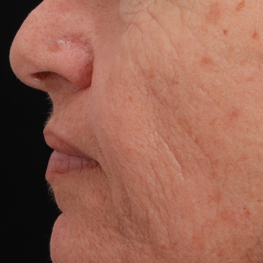 pic 2_ age 58 after.jpg