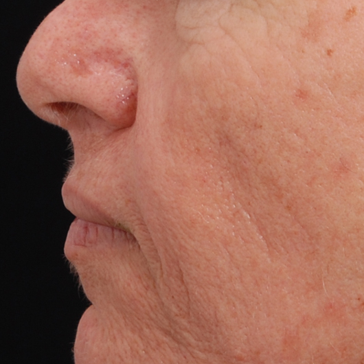 pic 2_age 58 before.jpg