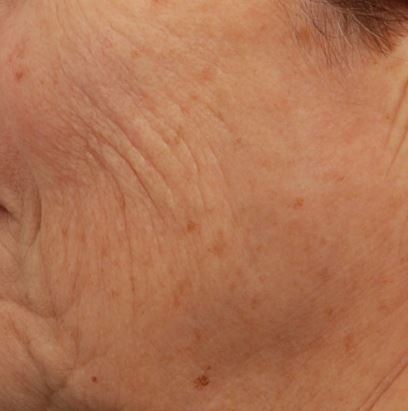 pic 3_age70 before.jpg
