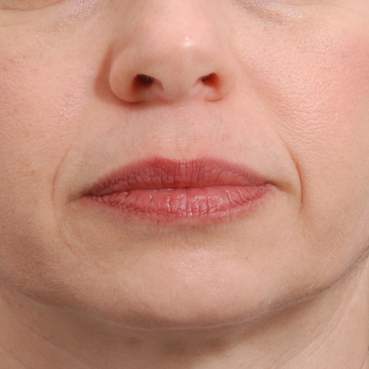 pic 6_age 58 after.jpg