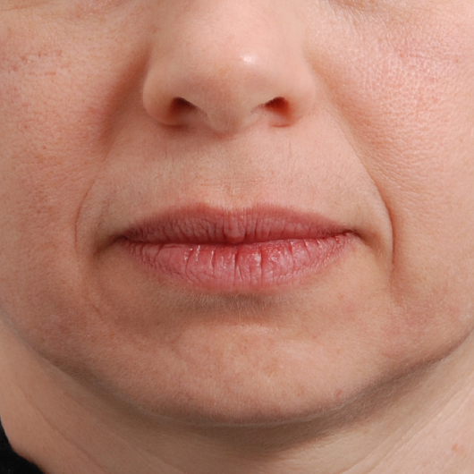 pic 6_age 58 before.jpg