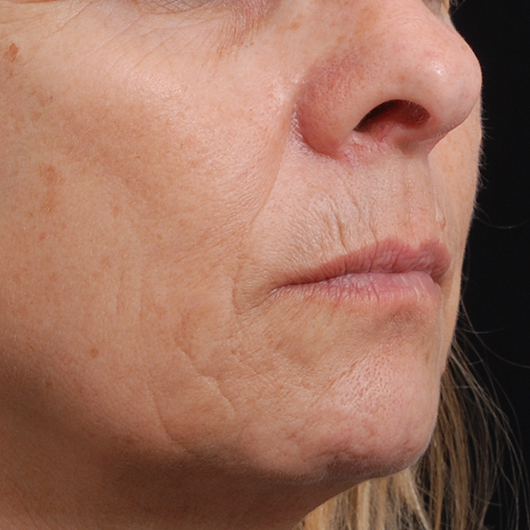pic 7_age 57 after.jpg