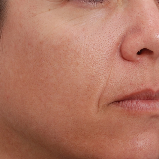 pic 8_age 42 after.jpg