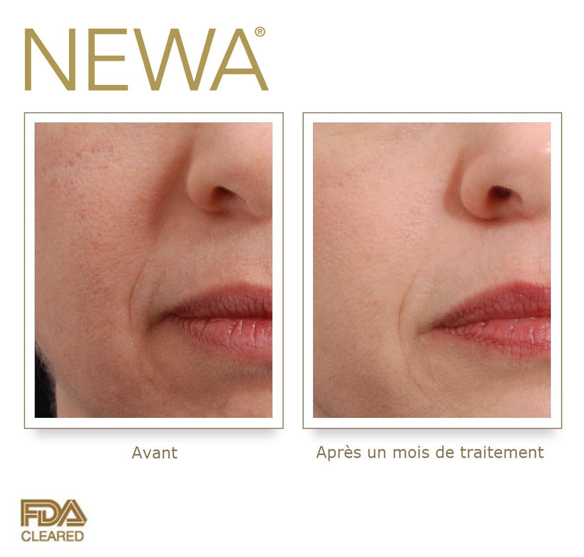 newa before  after_bouche.jpg