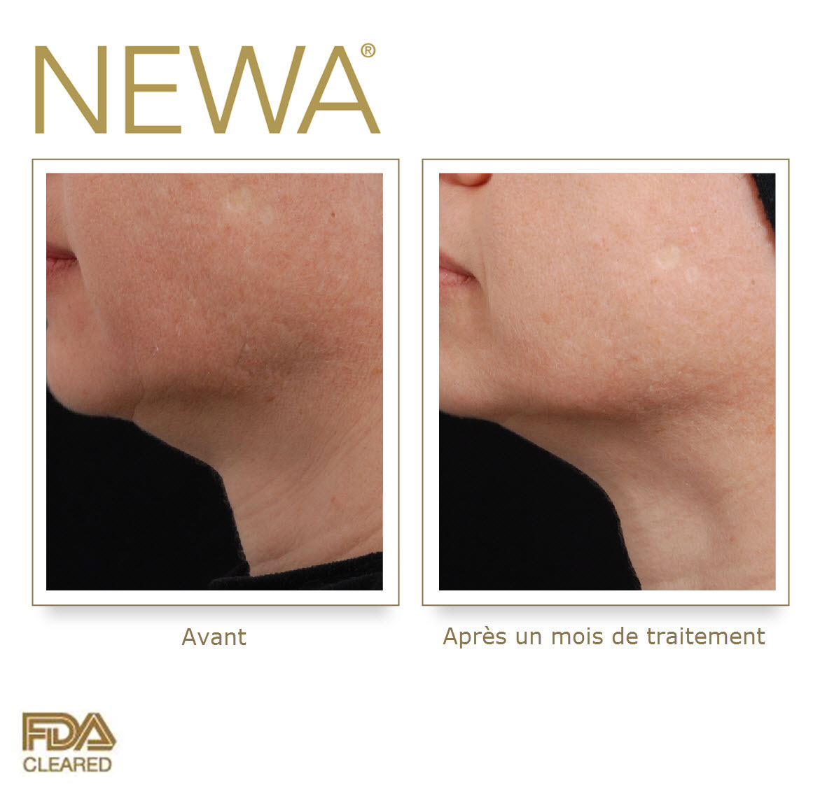 newa before  after_cou.jpg