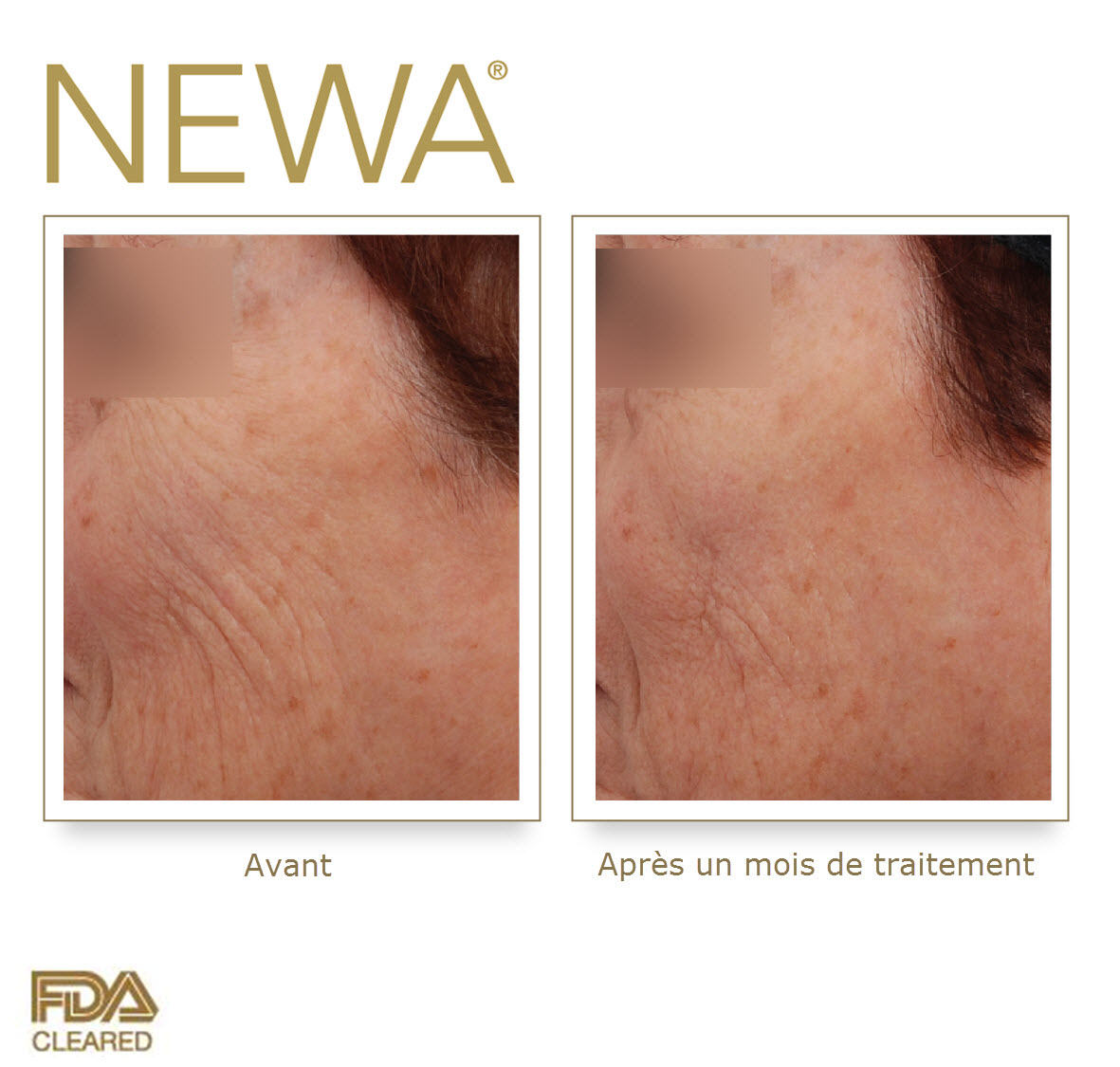 newa before  after_rides joues.jpg