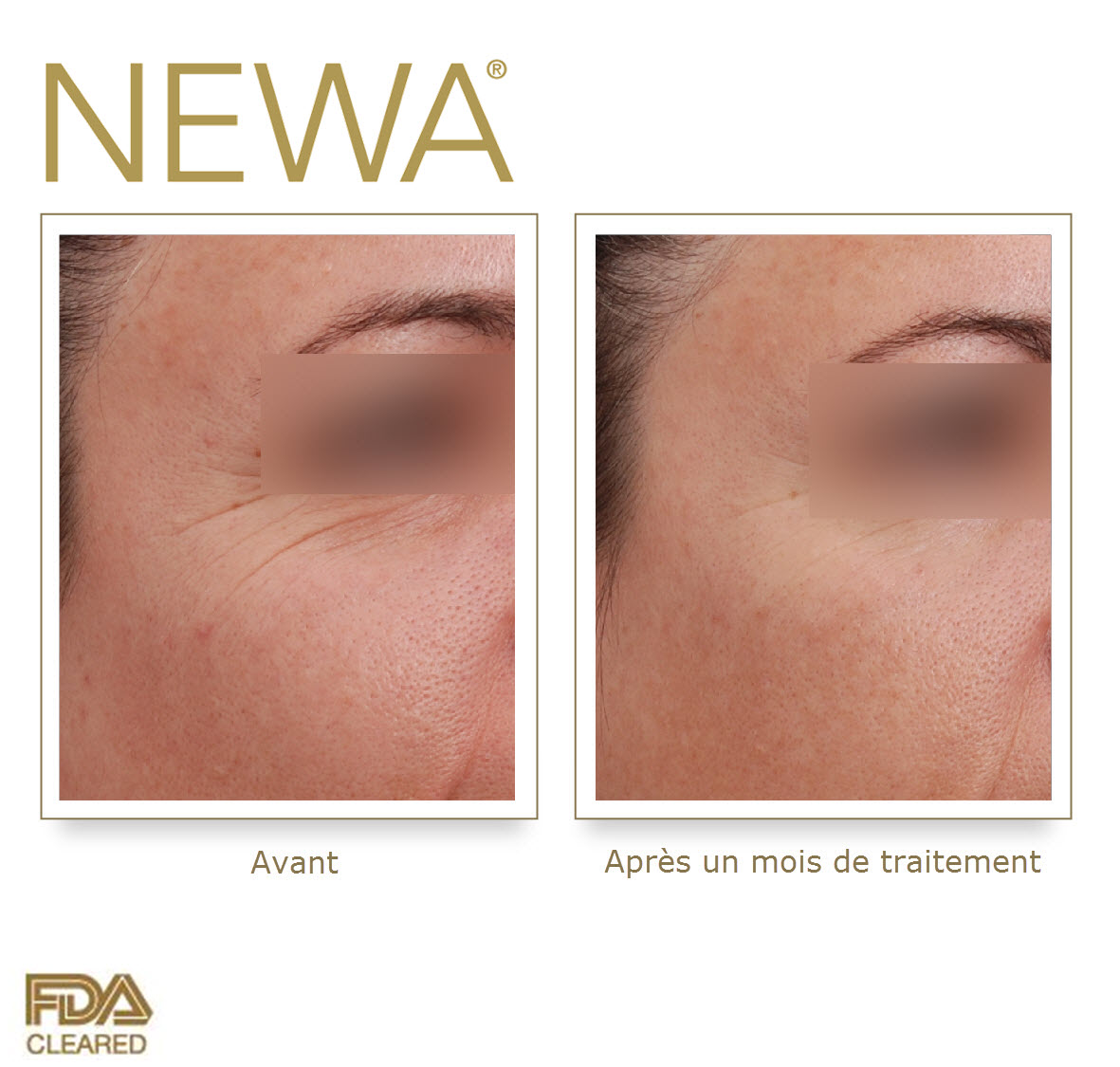 newa before  after_yeux.jpg